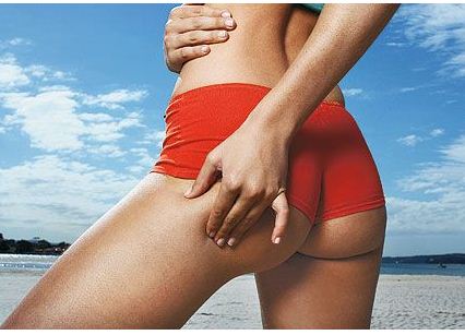 La cellulite scoperta la causa ecco come curarla